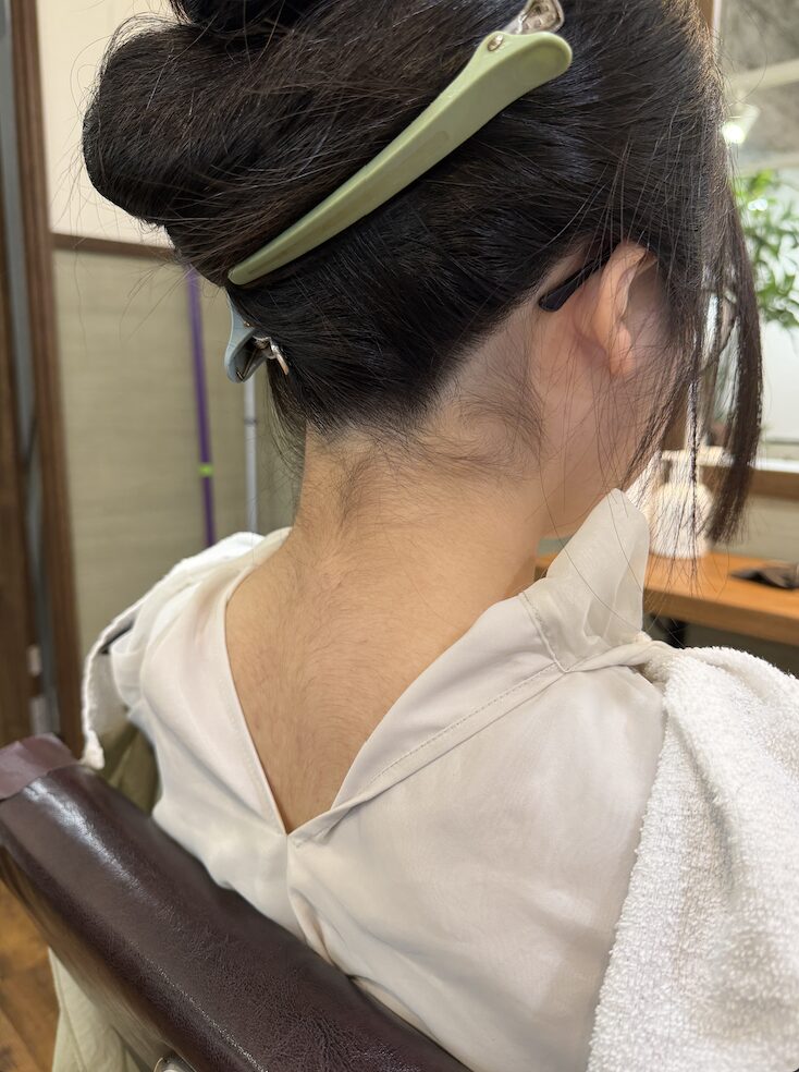 うなじ脱毛