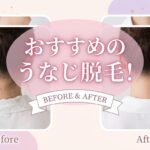 脱毛 リタヘア 中野坂上