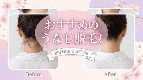 脱毛　リタヘア　中野坂上